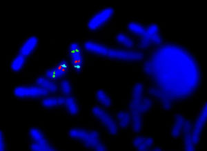 Picture of Fluorescence In Situ Hybridization
